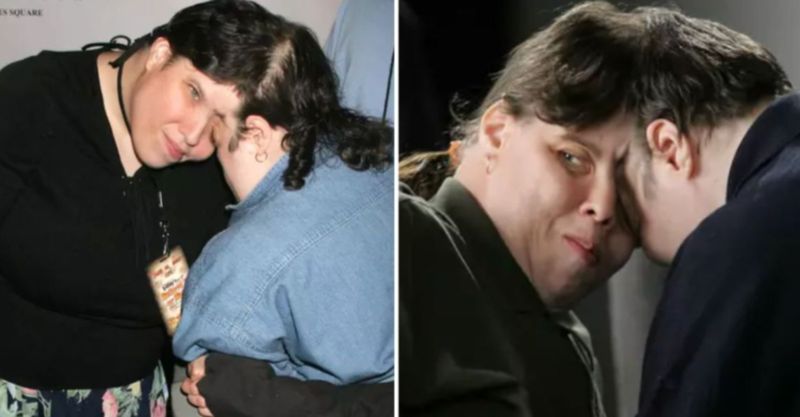 Cei doi frați siamezi au intrat în Cartea Recordurilor