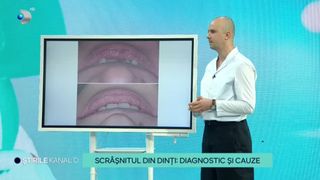 VIDEO- Scr&acirc;șnitul din dinți, afecțiunea despre care nu știm că o avem.  Din ce cauză apare această problemă, dar și ce opțiuni de tratament există &icirc;n acest caz