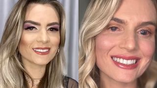 Și-a văzut moartea cu ochii după ce a luat un medicament pentru dureri menstruale! Corpul femeii a ars din interior, iar vederea i-a fost grav afectată. "Mă simt ca un războinic"