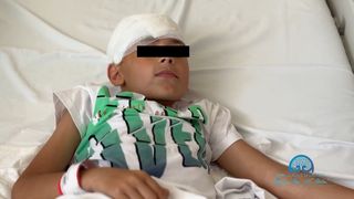 operatie, tumora, baiat operat cdreier, spital iasi 