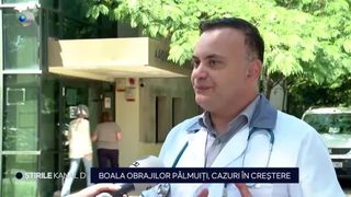 VIDEO Boala obrajilor pălmuiți, cazuri în creștere. Simptomele care trebuie să îi determine pe părinți să meargă la medic cu cei mici
