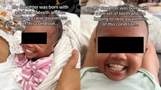 bebelus, dinti lapte, dantura completa 