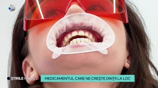 VIDEO Medicamentul care ne crește dinții la loc! Cum funcționează și de c&acirc;nd va intra &icirc;n teste?