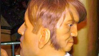 Povestea omului care s-a născut cu două fețe. "Nu știu ce blestem m-a legat de acest demon". Care a fost ultima dorință a bărbatului considerat un monstru, &icirc;nainte de a se sinucide