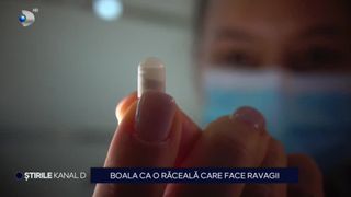 VIDEO Boala care se aseamănă cu o răceală, dar care poate face ravagii! Din 10 persoane infectate, 3 pot să moară