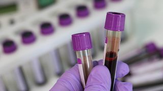 Analize de sânge revelatoare pentru "centenari"