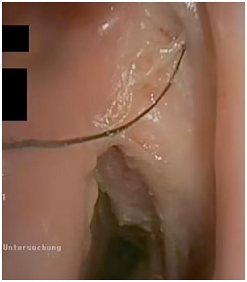 Ce a pățit un bărbat care a fumat timp de 30 de ani