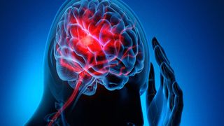 Noi terapii &icirc;mpotriva durerilor de cap