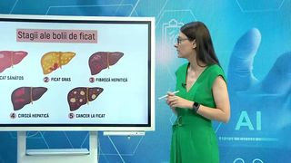 VIDEO Boala ficatului gras este o afecțiune pe care o au foarte mulți rom&acirc;ni! Cum se poate trata?