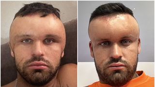 Cum te testezi dacă ești alergic la vopseaua de păr