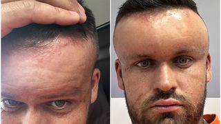 Reacția alergică i-a uimit și pe medici