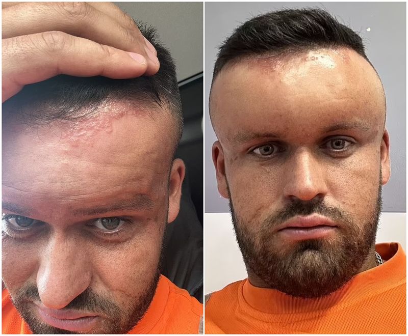 Reacția alergică i-a uimit și pe medici