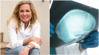 "Am văzut același simptom la toți bolnavii &icirc;nainte să primească diagnosticul de cancer". Dezvăluirea-șoc a unui medic oncolog