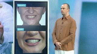 VIDEO Cum tratați strungăreața? Iată ce spune un specialist!