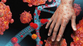 Variola maimuței, declarată "urgență sanitară la nivel mondial" de OMS, după ce a înghițit toată Africa. Cum se manifestă boala?