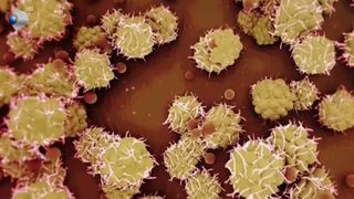 Alertă sanitară mondială! A apărut primul caz de mpox &icirc;n Europa, pentru prima dată &icirc;n afara Africii