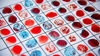 A fost descoperită o nouă grupă de sânge: ”Cazurile sunt foarte rare”