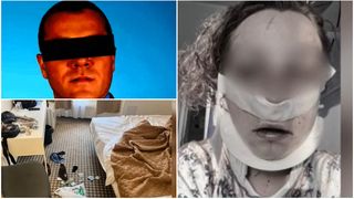 VIDEO  "Nu știu cum am scăpat". Tânăra bătută cu bestialitate într-o cameră de hotel, la Iași, face mărturii șocante. Agresorul este un fost iubit din liceu, avocat celebru în prezent