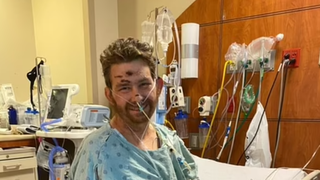 Un fir de păr crescut sub piele l-a băgat pe un bărbat în comă. Medicii nu îi mai dădeau nicio șansă