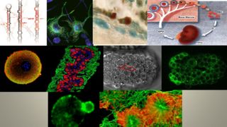 Secretul din lupta &icirc;mpotriva tumorilor maligne