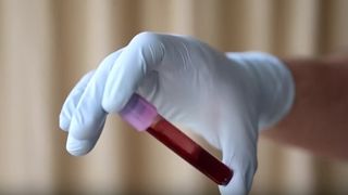 VIDEO Suntem cei mai bolnavi pacienți ai Europei. Speranța de viață a rom&acirc;nilor, extrem de scăzută 