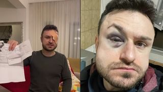 VIDEO &bdquo;Am fost cu ochiul spart la muncă&rdquo;. Glumă amară: &icirc;n loc să r&acirc;dă, i-a dat un pumn