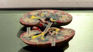 Lecție de anatomie la Biblioteca Națională