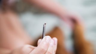 Gestul aparent inofensiv care agravează mușcătura de căpușă. Conf.univ.dr. Tudor Ciuhodaru avertizează: "Mergeți la medic dacă apar simptomele variate ale așa-numitei "gripe de vară" &icirc;nsoţită de dureri musculare"