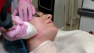VIDEO &bdquo;Durerea este minimă&rdquo;. Piele strălucitoare cu ajutorul laserului