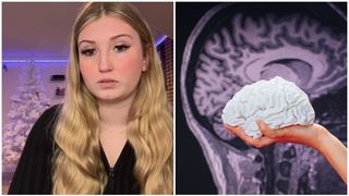 "Simptomul pe care l-am ignorat din copilărie ascundea un cancer cerebral mortal" Ce a descoperit o t&acirc;nără de 20 de ani după multe vizite la medici