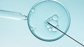 VIDEO Fertilizarea in vitro, pas cu pas! Sfaturile medicului Andreas Vythoulkas