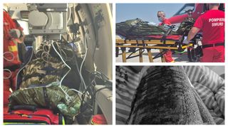 VIDEO „Am plătit cu pielea de pe mine. Simțeam cum se desprind părți din mine” Scrisoare sfâșietoare a unei paciente, adresată ministrului Sănătății, după 7 zile de iad într-un spital de arși din București