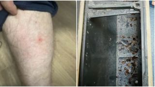 VIDEO Polițiștii bucureșteni, mușcați de ploșnițe! Mai mulți oameni ai legii ar fi ajuns la urgențe