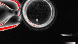 Oamenii de știință au creat embrioni umani din ADN-ul pielii. Moment revoluționar în medicină