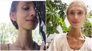 Sfârșit tragic pentru o tânără de 27 de ani care s-a înfometat până la moarte cu o dietă "fructariană” crudă