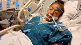 „Cât poate îndura un om?!” O femeie de 34 de ani a  rămas fără mâini și picioare după ce a fost atacată de un câine. Momentul în care viața i s-a schimbat pentru totdeauna