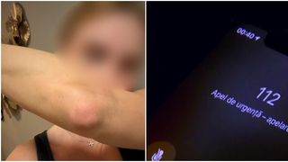 VIDEO „A început să îmi curgă sânge din nas”. Conflict violent între un polițist din trupele speciale și iubita sa