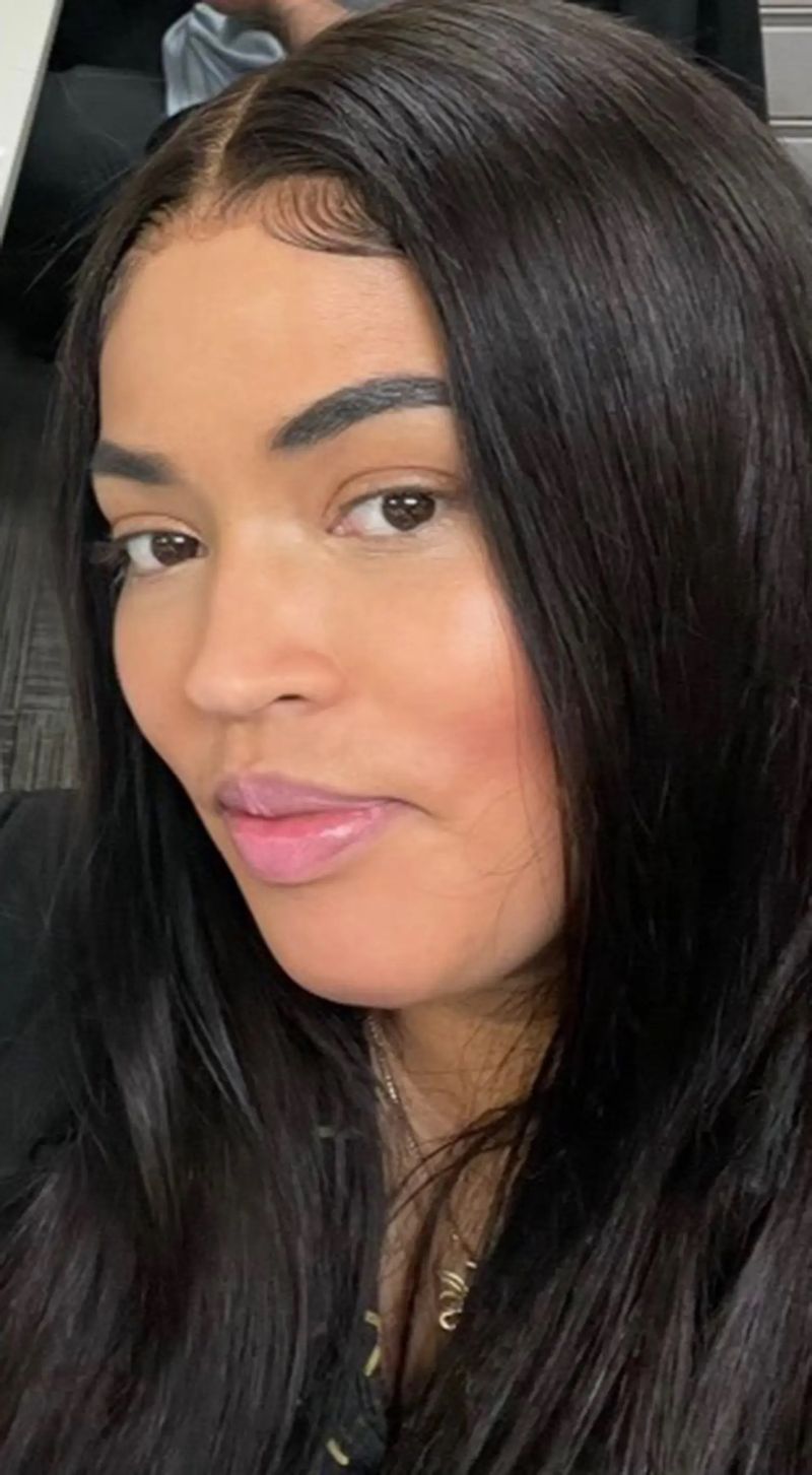 Polițista de 40 de ani, moarte suspectă după o operație estetică banală