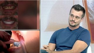 VIDEO Tot mai mulți români aleg să-și corecteze zâmbetul. Recomandările lui Alexandru Meroiu, medic stomatolog