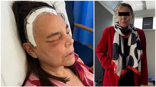 O femeie a stat imobilizată la pat 2 ani după ce medicii i-au pus mai multe diagnostice greșite. Diagnosticul crunt primit după un RMN prin sedare