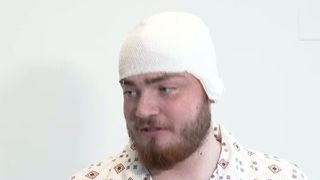 VIDEO Povestea lui Alin, tânărul care a fost operat pe creier în timp ce era treaz: „Acum mă simt ca un nou născut”