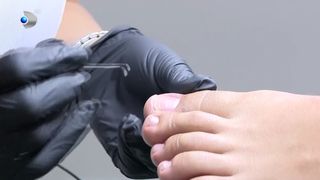 VIDEO Pedichiura medicală, soluția pentru unghii sănătoase