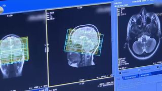 Tot mai mulți tineri fac AVC