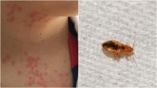 Incident șocant la bord! O familie susține că a fost mușcată de ploșnițe &icirc;n avion și cere despăgubiri uriașe