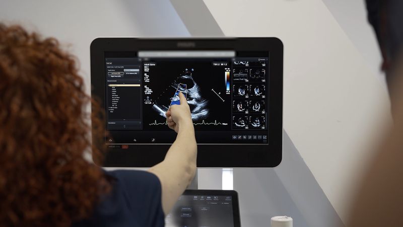 Diagnostic: o malformație congenitală rară a inimii 