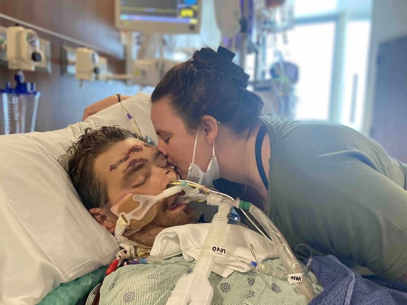 Bărbat ajuns în comă după ce a încercat să își scoată un fir de păr crescut sub piele