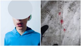 VIDEO Momentul &icirc;n care un adolescent de 14 ani a fost bătut cu sălbăticie de un băiat mai mare. Se &icirc;ntorcea de la școală atunci c&acirc;nd a fost lovit cu pumnii și picioarele p&acirc;nă c&acirc;nd nu s-a mai putut mișca