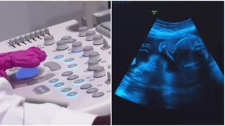 VIDEO Veste bună pentru cuplurile infertile! Guvernul vrea continuarea programului FIV