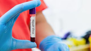 Virusul Nipah