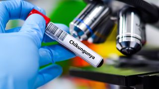 Ce este și cum se manifestă virusul Chikungunya? Principalele simptome